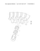 METHOD AND APPARATUS FOR MINIMALLY INVASIVE INSERTION OF INTERVERTEBRAL     IMPLANTS diagram and image