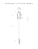 METHOD AND APPARATUS FOR MINIMALLY INVASIVE INSERTION OF INTERVERTEBRAL     IMPLANTS diagram and image