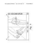 METHOD AND SYSTEM FOR MANAGING INVENTORIES OF ORTHOPAEDIC IMPLANTS diagram and image