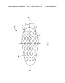 Toothbrush Apparatus With An Arcuate Toothbrush Head And Bristle     Configuration diagram and image