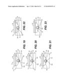 Pivoting Thumb Stop System and Method diagram and image