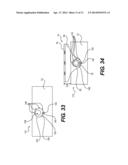 Pivoting Thumb Stop System and Method diagram and image