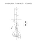 COPPER ANODE REFINING SYSTEM AND METHOD diagram and image