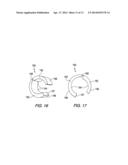 TENSION WINDOW RODS diagram and image