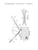 TOUCH FASTENING diagram and image