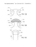 TOUCH FASTENING diagram and image