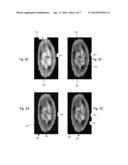 NOVEL MAGNETIC RESONANCE-BASED SYSTEMS FOR DETECTING CONTAMINATING     PARTICLES AND METHODS THEREOF diagram and image