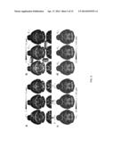 SYSTEMS AND METHODS FOR SUSCEPTIBILITY TENSOR IMAGING IN THE P-SPACE diagram and image