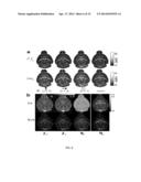 SYSTEMS AND METHODS FOR SUSCEPTIBILITY TENSOR IMAGING IN THE P-SPACE diagram and image