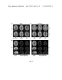 SYSTEMS AND METHODS FOR SUSCEPTIBILITY TENSOR IMAGING IN THE P-SPACE diagram and image