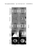 SYSTEMS AND METHODS FOR SUSCEPTIBILITY TENSOR IMAGING IN THE P-SPACE diagram and image