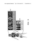 MEDICAL IMAGE DISPLAY METHOD USING VIRTUAL PATIENT MODEL AND APPARATUS     THEREOF diagram and image