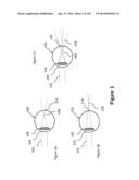 Lenses, Devices, Methods and Systems for Refractive Error diagram and image