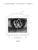 FULL-EYE ILLUMINATION OCULAR SURFACE IMAGING OF AN OCULAR TEAR FILM FOR     DETERMINING TEAR FILM THICKNESS AND/OR PROVIDING OCULAR TOPOGRAPHY diagram and image