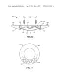 LOW PROFILE LIGHT AND ACCESSORY KIT FOR SAME diagram and image