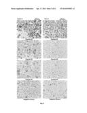 MOLECULES SPECIFICALLY BINDING PANCREATIC BETA CELLS BIOMARKERS diagram and image