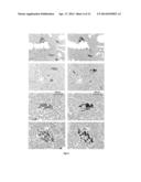 MOLECULES SPECIFICALLY BINDING PANCREATIC BETA CELLS BIOMARKERS diagram and image