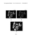 MOLECULES SPECIFICALLY BINDING PANCREATIC BETA CELLS BIOMARKERS diagram and image