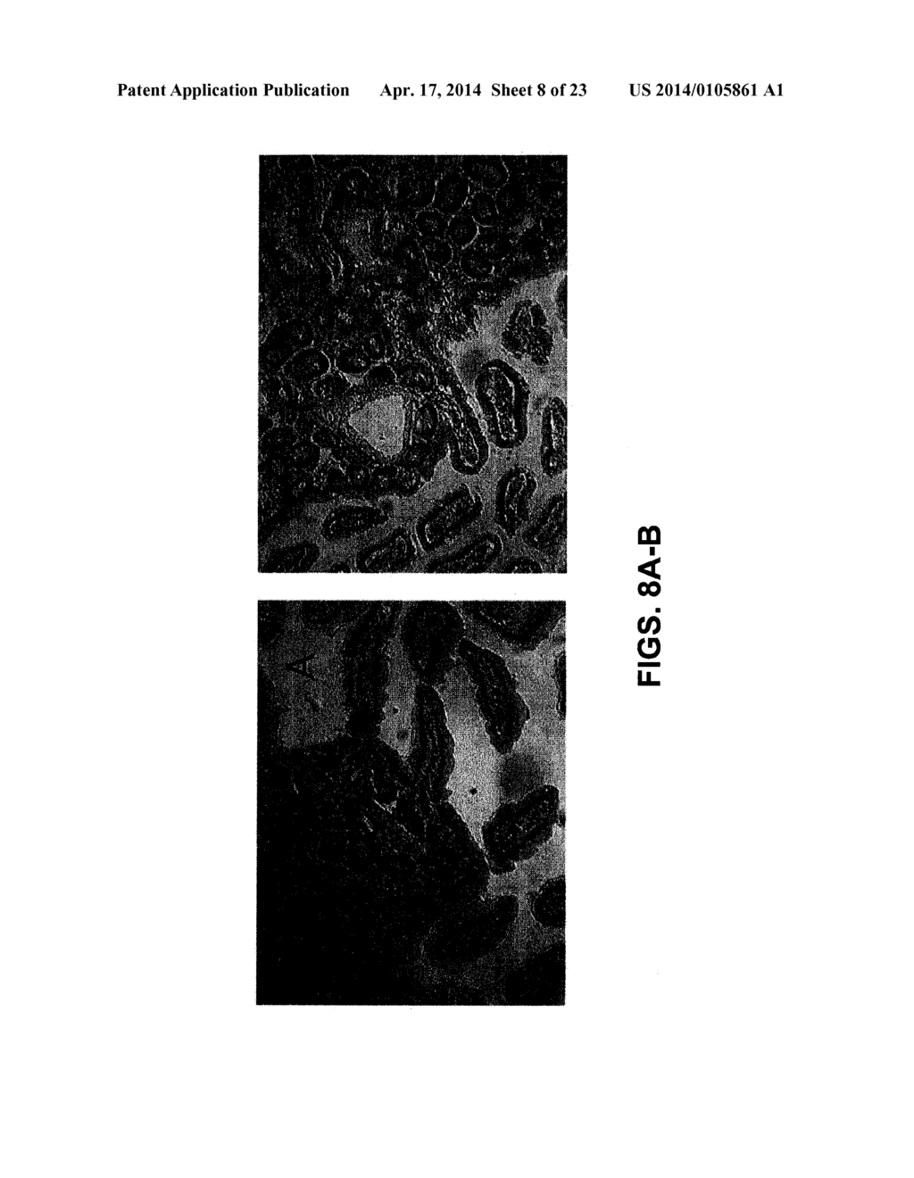 COMPOSITIONS AND METHODS FOR TREATING ENDOCRINE, GASTROINTESTINAL OR     AUTOIMMUNE DISORDERS - diagram, schematic, and image 09