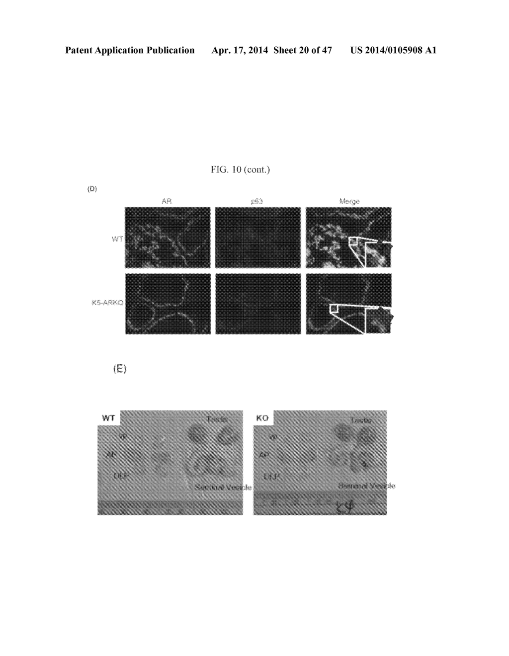 METHODS FOR TREATING PROSTATE CANCER - diagram, schematic, and image 21