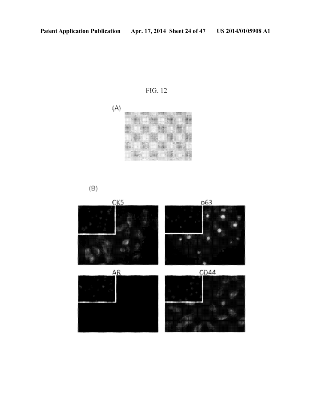 METHODS FOR TREATING PROSTATE CANCER - diagram, schematic, and image 25