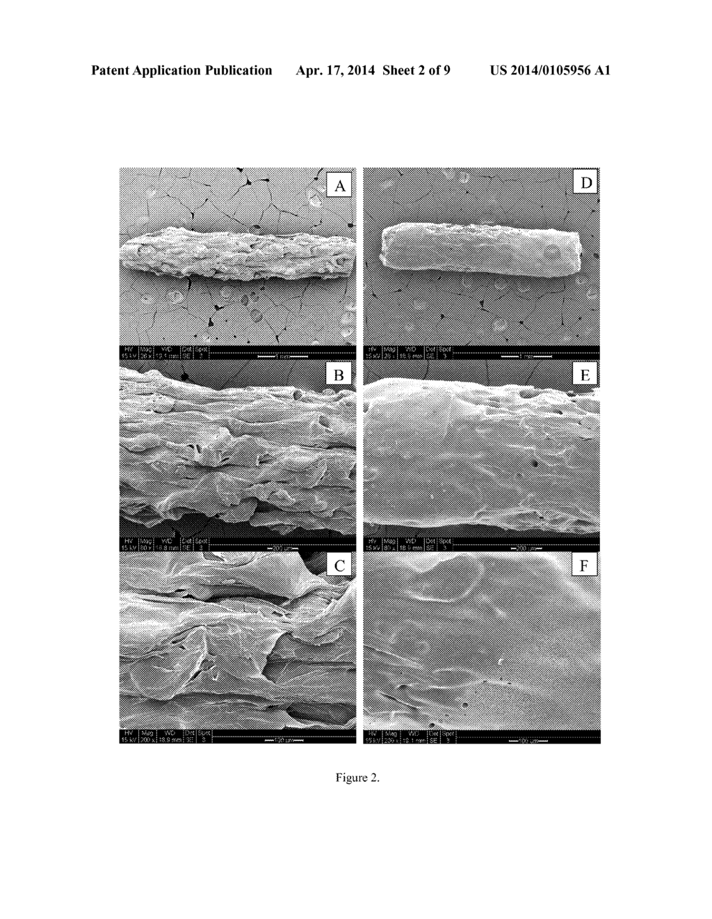 BIODEGRADABLE POLYMER BASED MICROIMPLANT FOR OCULAR DRUG DELIVERY - diagram, schematic, and image 03