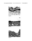 METHODS AND COMPOSITIONS FOR MAINTAINING AND IMPROVING THE HEALTH OF SKIN diagram and image