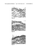 METHODS AND COMPOSITIONS FOR MAINTAINING AND IMPROVING THE HEALTH OF SKIN diagram and image