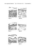 METHODS AND COMPOSITIONS FOR MAINTAINING AND IMPROVING THE HEALTH OF SKIN diagram and image