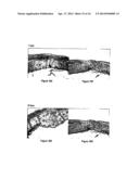 METHODS AND COMPOSITIONS FOR MAINTAINING AND IMPROVING THE HEALTH OF SKIN diagram and image