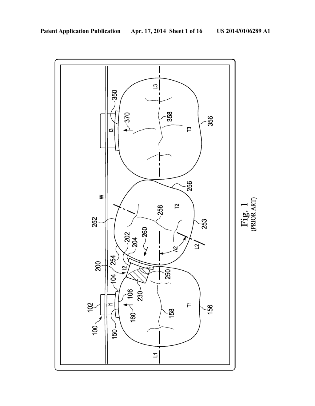 Sequential Modules for Computer Aided Bracketing Systems and Associated     Methods and Devices - diagram, schematic, and image 02