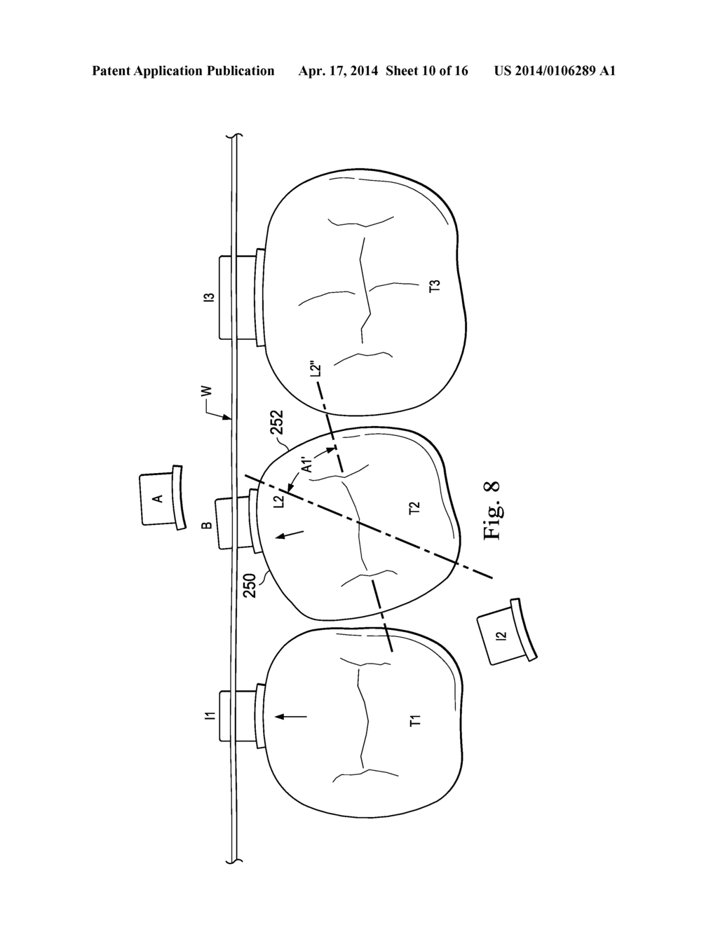 Sequential Modules for Computer Aided Bracketing Systems and Associated     Methods and Devices - diagram, schematic, and image 11