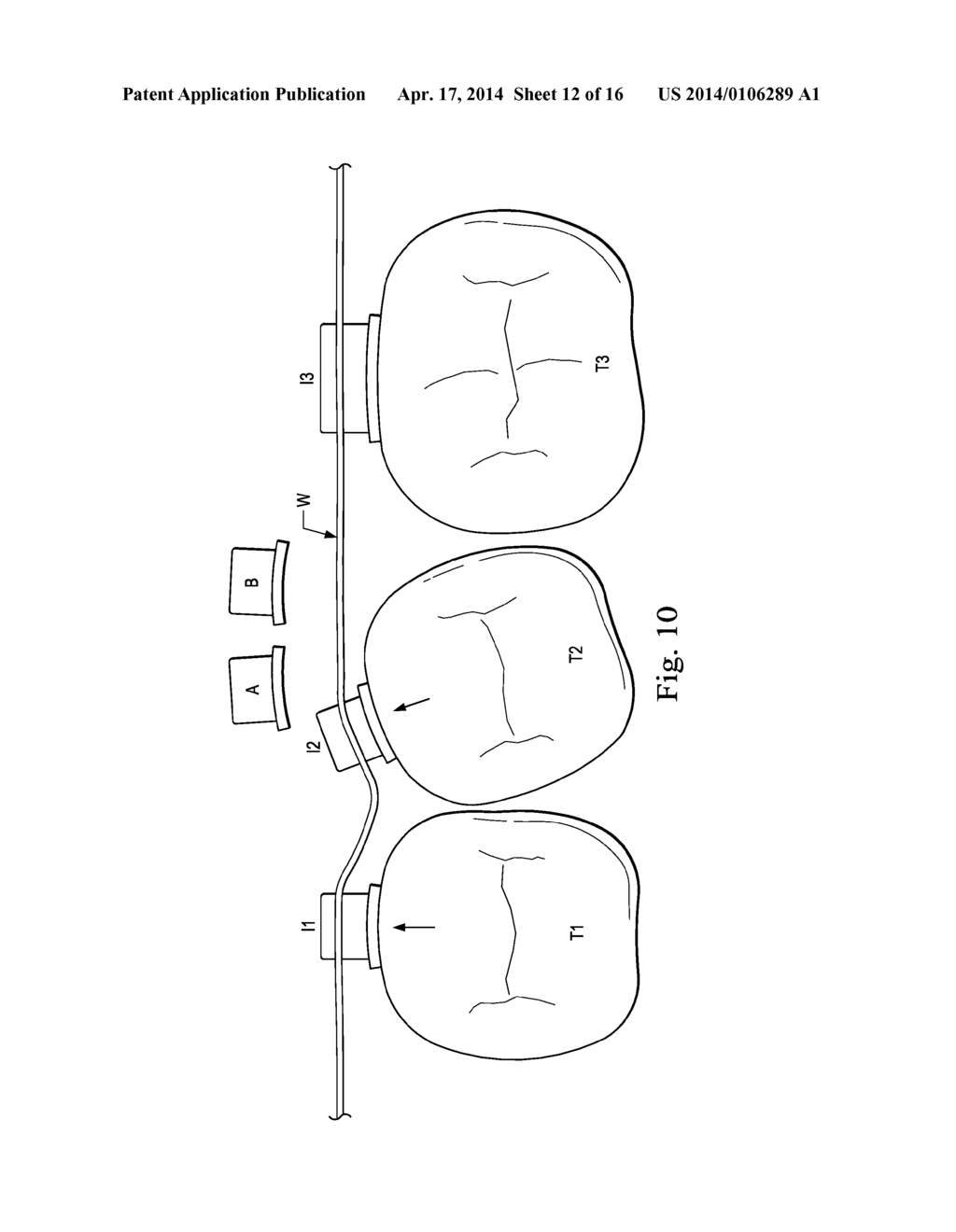 Sequential Modules for Computer Aided Bracketing Systems and Associated     Methods and Devices - diagram, schematic, and image 13