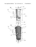 COMPRESSIVE DENTAL IMPLANT diagram and image