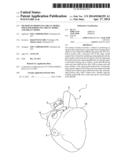 METHOD OF PRODUCING ORGAN MODEL, MOLD FOR PRODUCING ORGAN MODEL, AND ORGAN     MODEL diagram and image