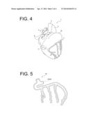 METHOD OF PRODUCING ORGAN MODEL, MOLD FOR PRODUCING ORGAN MODEL, AND ORGAN     MODEL diagram and image