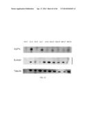 BIOMARKERS FOR AGGRESSIVE PROSTATE CANCER diagram and image