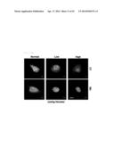 METHOD FOR DIAGNOSING GLIOMA AND SCREENING FOR THE THERAPEUTICS OF GLIOMA     THROUGH IDENTIFYING PROTEIN RELOCATION diagram and image