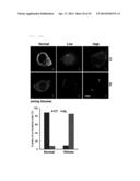 METHOD FOR DIAGNOSING GLIOMA AND SCREENING FOR THE THERAPEUTICS OF GLIOMA     THROUGH IDENTIFYING PROTEIN RELOCATION diagram and image