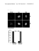 METHOD FOR DIAGNOSING GLIOMA AND SCREENING FOR THE THERAPEUTICS OF GLIOMA     THROUGH IDENTIFYING PROTEIN RELOCATION diagram and image