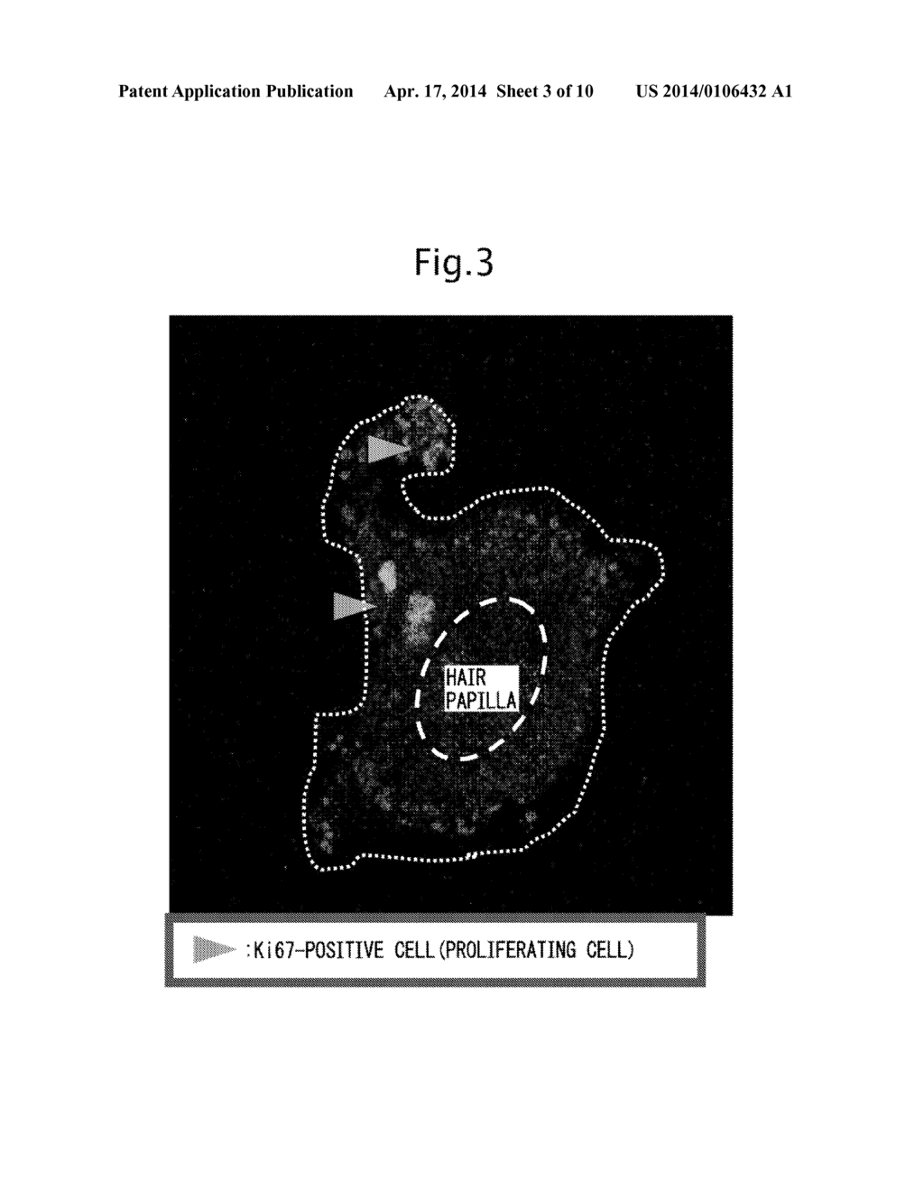 CELL MASS CAPABLE OF SERVING AS A PRIMITIVE ORGAN-LIKE STRUCTURE COMPRISED     OF A PLURALITY OF CELL TYPES OF SOMATIC ORIGIN - diagram, schematic, and image 04