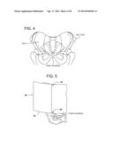 EXERCISE BELT diagram and image