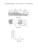 POLYPEPTIDE COMPOUNDS FOR INHIBITING ANGIOGENESIS AND TUMOR GROWTH diagram and image