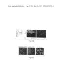 POLYPEPTIDE COMPOUNDS FOR INHIBITING ANGIOGENESIS AND TUMOR GROWTH diagram and image