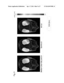 BRAIN FUNCTION IMPROVING AGENT diagram and image