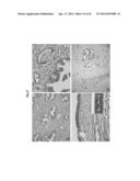 Bifunctional AKR1C3 Inhibitors/Androgen Receptor Modulators and Methods of     Use Thereof diagram and image