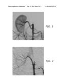 POLYMERIC TREATMENT COMPOSITIONS diagram and image