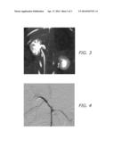 POLYMERIC TREATMENT COMPOSITIONS diagram and image