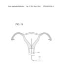 SYSTEMS, METHODS AND DEVICES FOR PERFORMING GYNECOLOGICAL PROCEDURES diagram and image