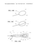 SYSTEMS, METHODS AND DEVICES FOR PERFORMING GYNECOLOGICAL PROCEDURES diagram and image